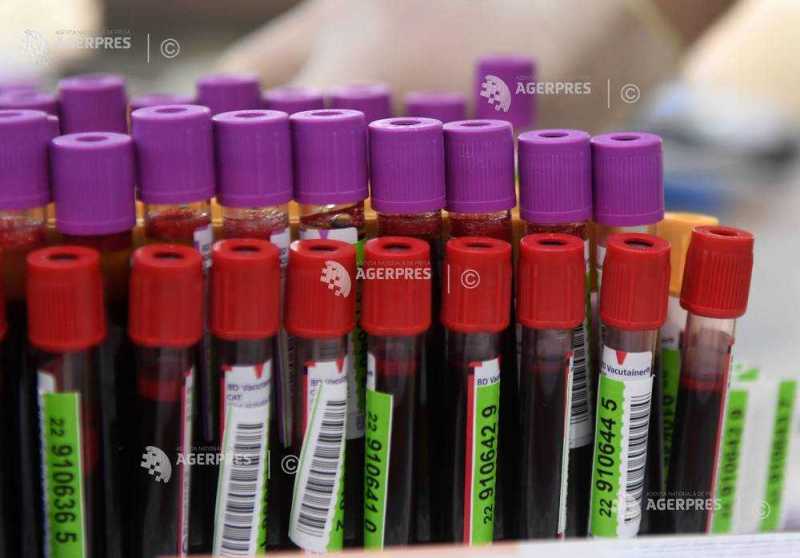 O genă care ajută bacteriile intestinale dăunătoare să reziste la antibiotice și dezinfectanți, descoperită de cercetători australieni